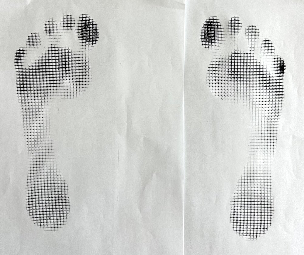 A pedograph of two feet, a left and a right, showing pressure distribution during gait through all parts of the foot.