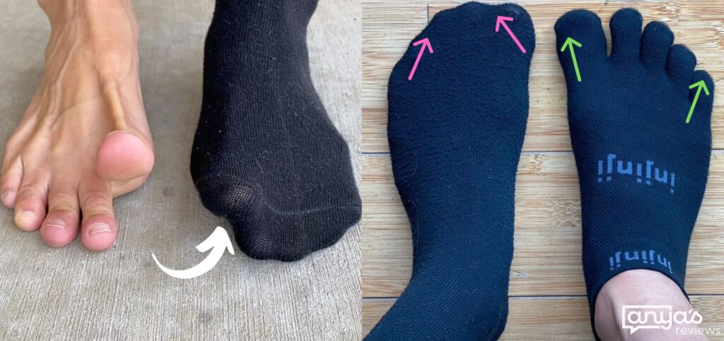 Side by side collage of 2 sock related images. The left image shows toe mobility being restricted by conventional socks. The right shows how conventional socks squish toes unlike toe socks.